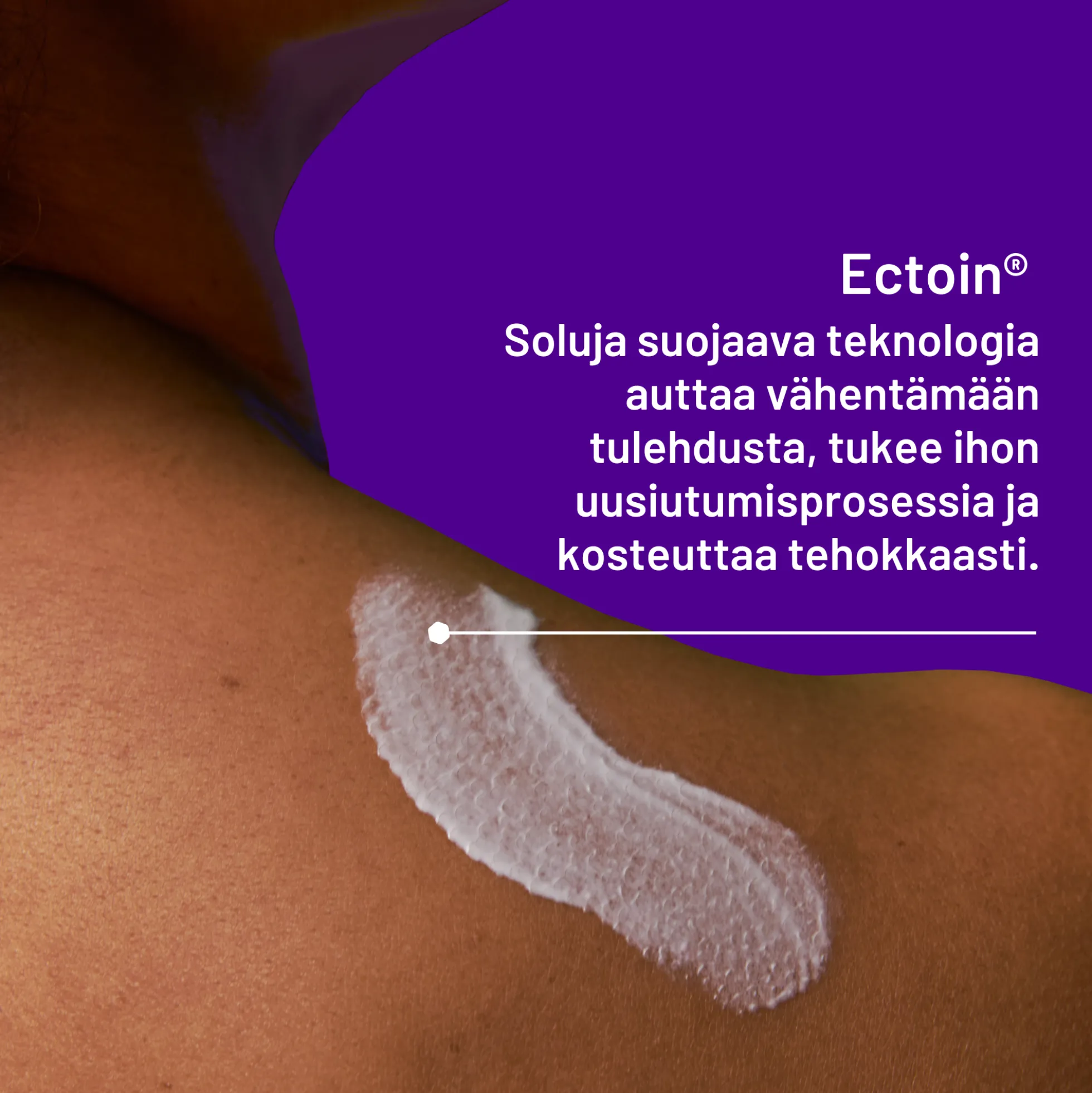 Locobase Psoriasis Cream 50 ml -kortisoniton voide psoriasiksen oireiden hoitoon ja ehkäisyyn