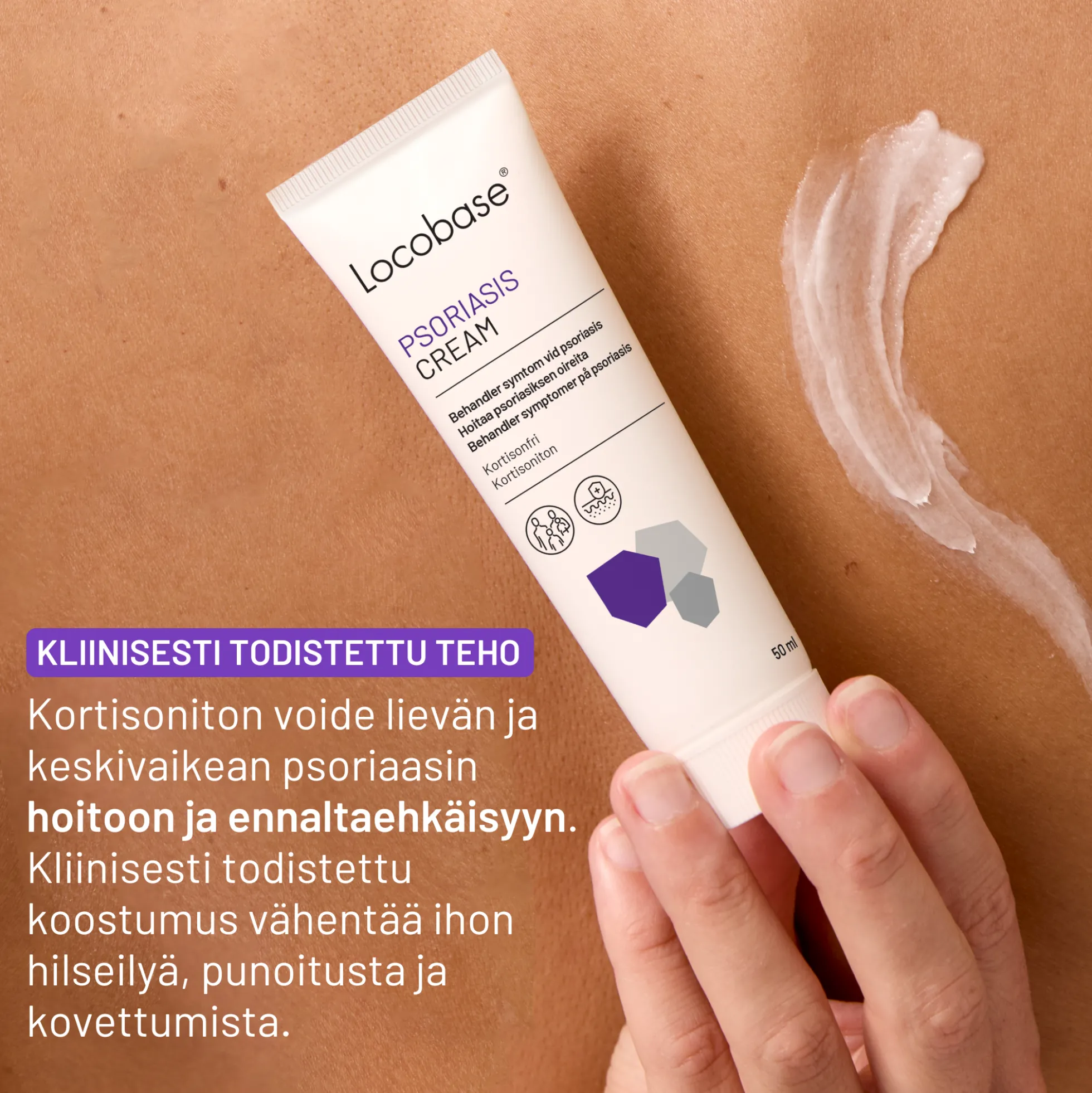 Locobase Psoriasis Cream 50 ml -kortisoniton voide psoriasiksen oireiden hoitoon ja ehkäisyyn