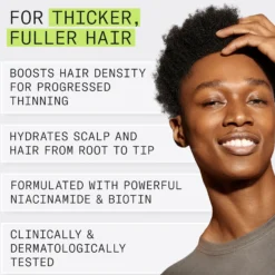 Nioxin System 2 Conditioner for Thinning Hair 300 ml - Hoitoaine selvästi ohentuneille hiuksille