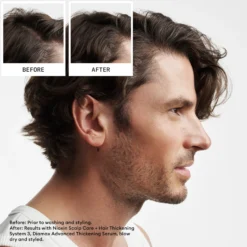 Nioxin System 2 Loyalty Kit for Thinning Hair 300 ml + 300 ml + 100 ml - Selvästi ohentuneille, käsittelemättömille hiuksille