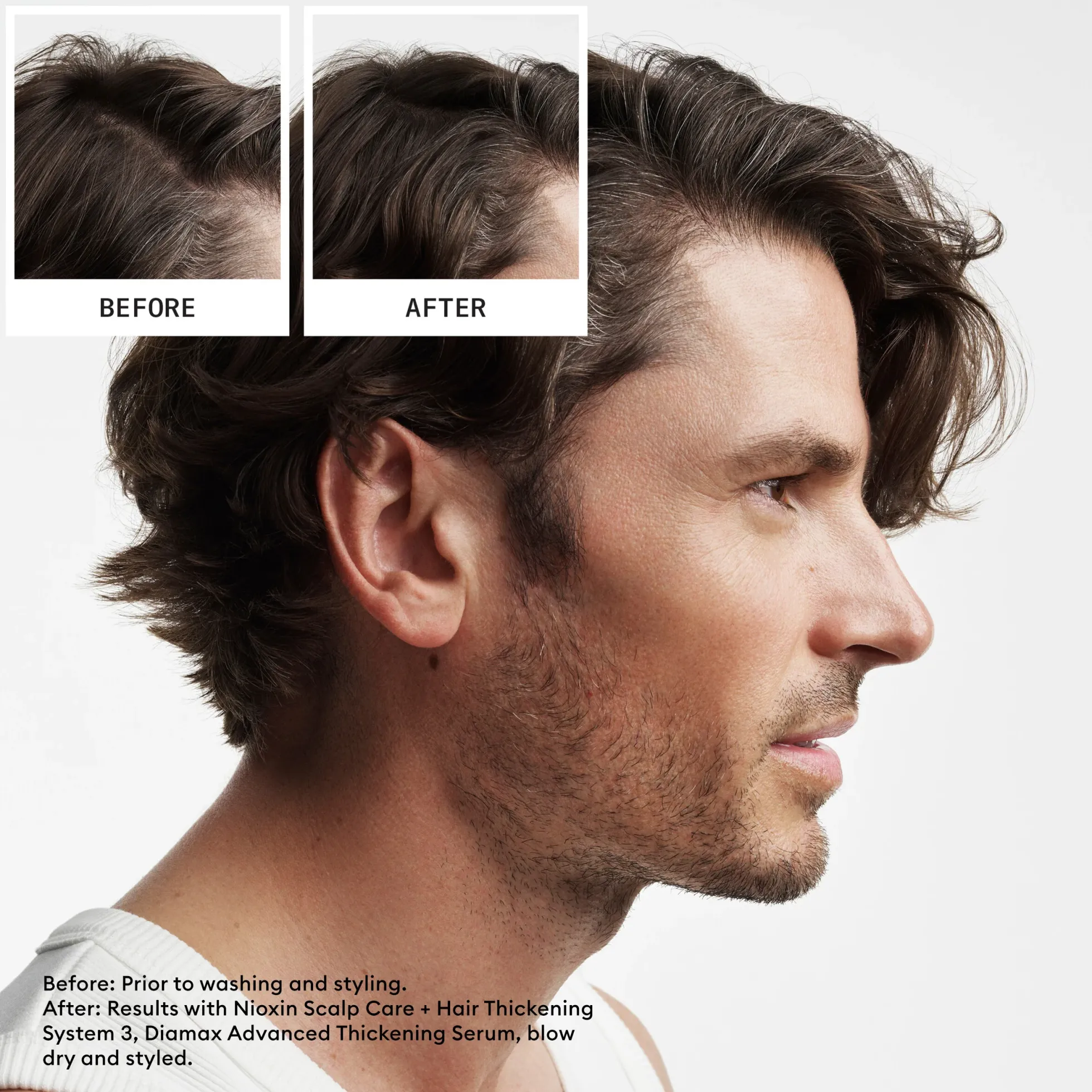 Nioxin System 2 Loyalty Kit for Thinning Hair 300 ml + 300 ml + 100 ml - Selvästi ohentuneille, käsittelemättömille hiuksille