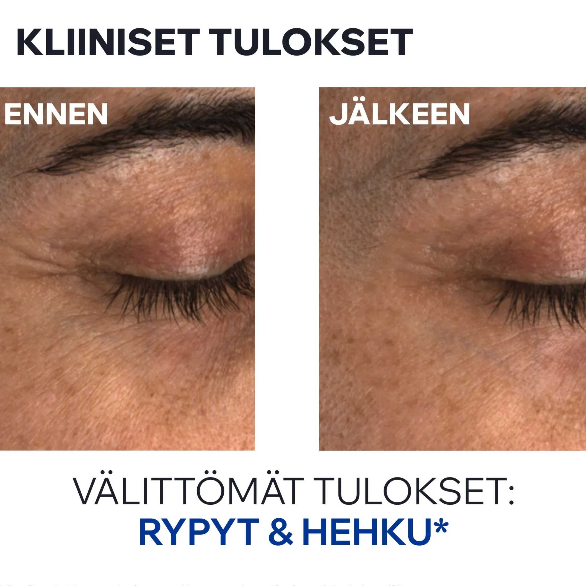 Uriage Age Absolu Blur-Redensifying Eye Balm kiinteyttävä silmänympärysvoide 15ml