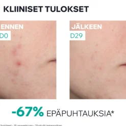 Uriage Hyseac New Skin Serum Anti-Blemish Booster