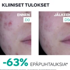 Uriage Hyseac 3-Regul+ Anti-Blemish Global Care