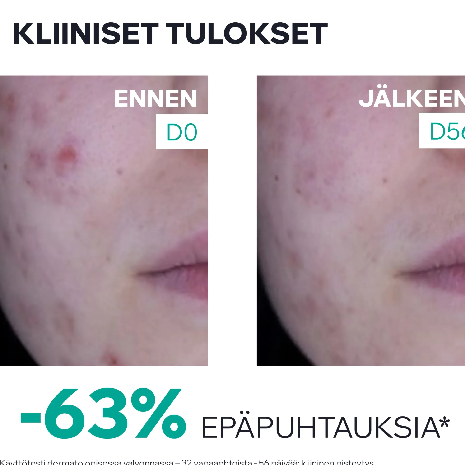 Uriage Hyseac 3-Regul+ Anti-Blemish Global Care