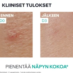 Uriage Hyseac SOS Paste