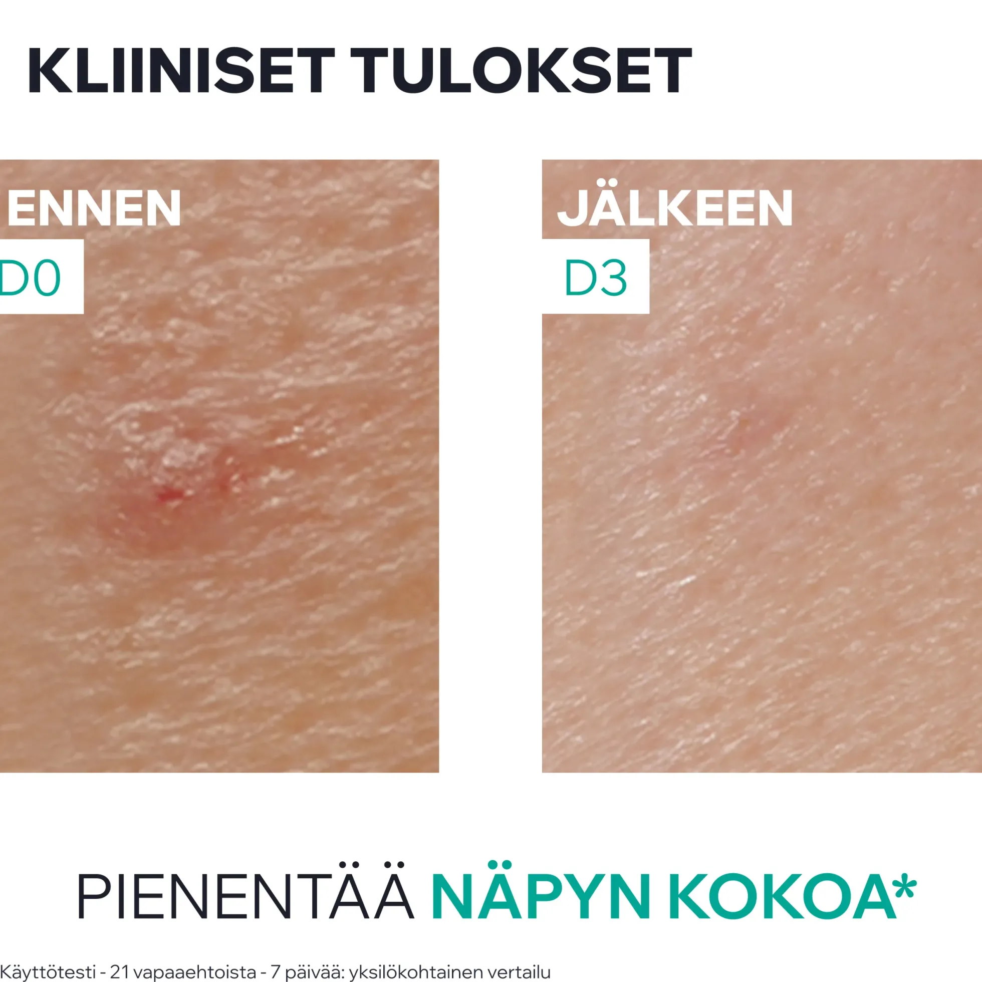 Uriage Hyseac SOS Paste